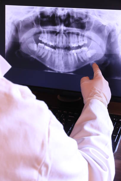 Best Chipped Tooth Repair Near Me  in Traverse City, MI