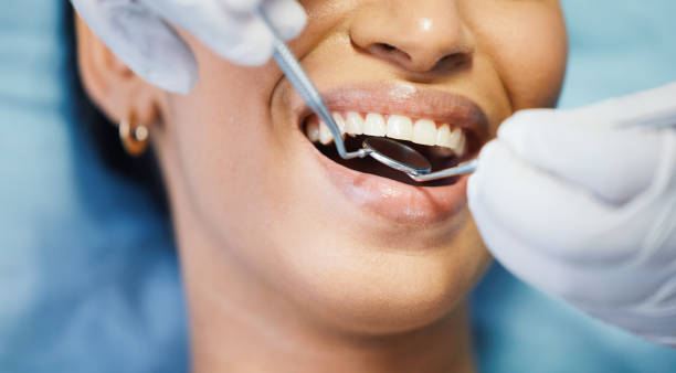 Best Knocked-Out Tooth Emergency  in Traverse City, MI