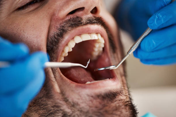 Best Knocked-Out Tooth Emergency  in Traverse City, MI